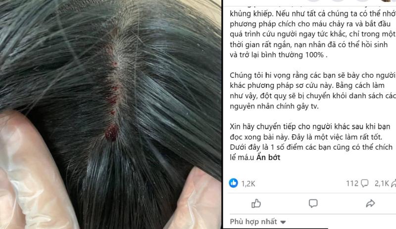 chua dot quy anh 1