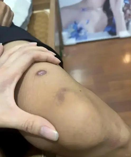 lua ban sang Myanmar anh 1