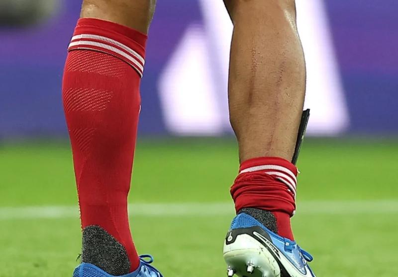 Van Dijk anh 1