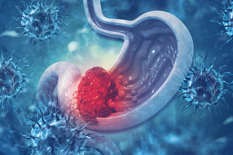 ung thu nam gioi anh 2