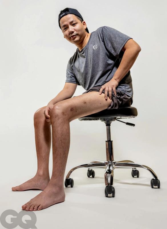 Khoa Pug keo chan anh 2
