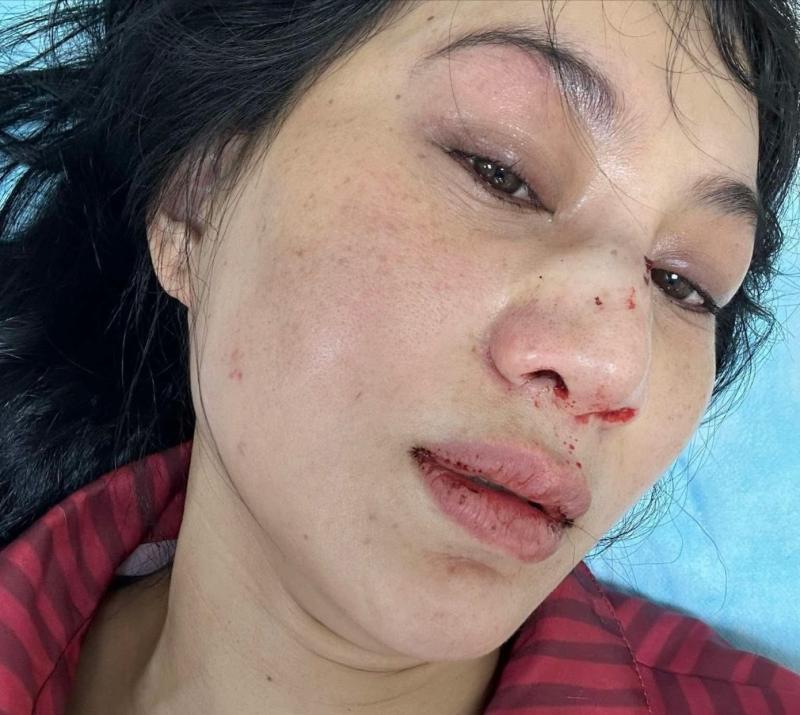 Ngoc Anh anh 2
