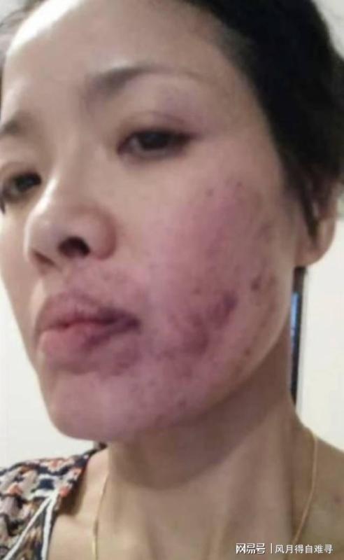 Bao Boi Nhu anh 1