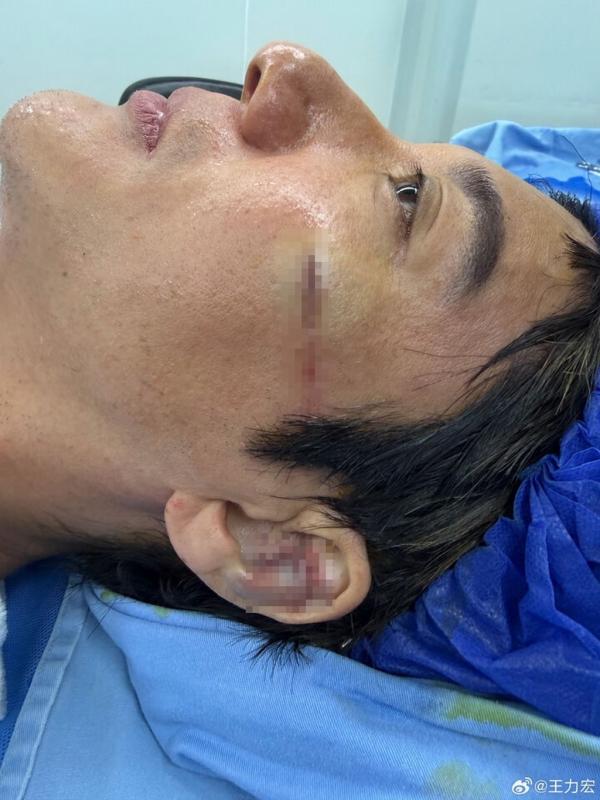Vương Lực Hoành ảnh 2
