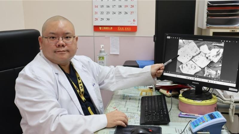 Sùi mào gà ảnh 1
