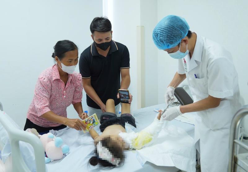 Cánh tay ảnh 1