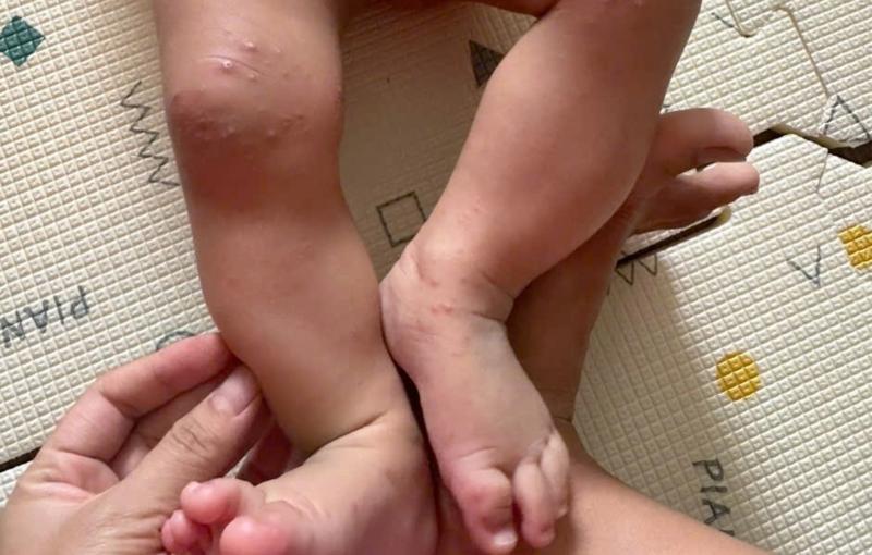 Vaccine tay chân miệng ảnh 3